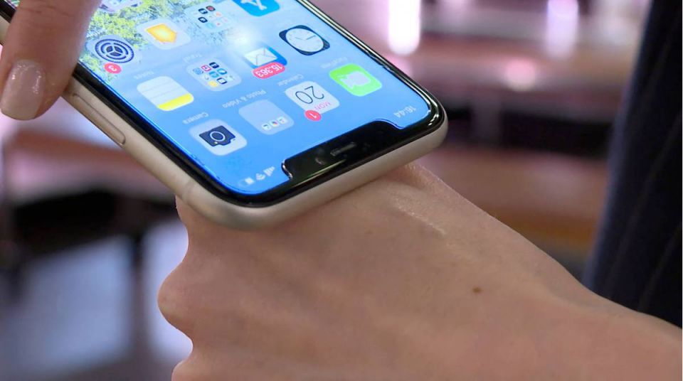 &quot;Del tamaño de un arroz&quot;: implante de microchip podría ser nuevo pase de movilidad